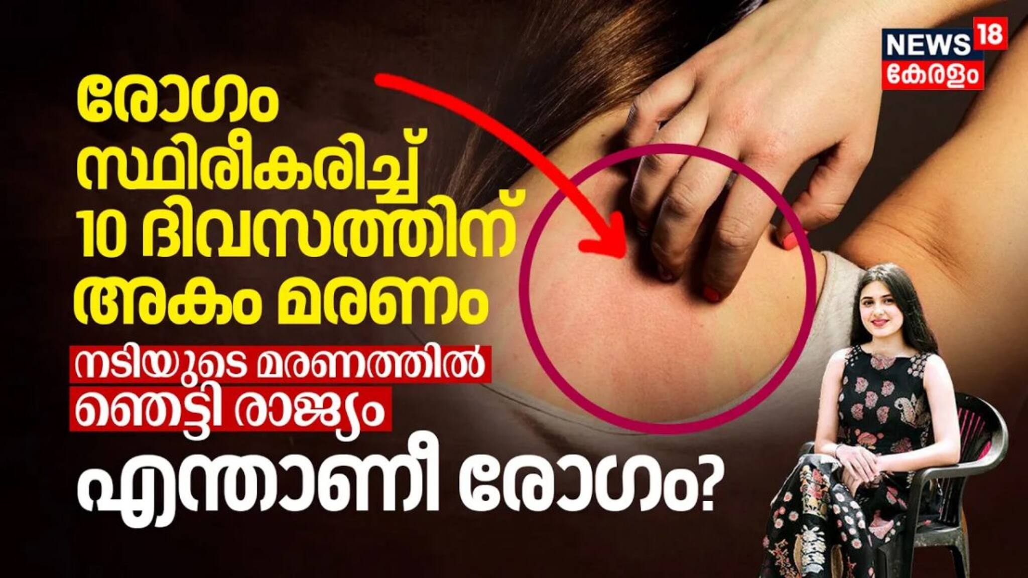 രോഗം സ്ഥിരീകരിച്ച്‌ 10 ദിവസത്തിനകം മരണം, നടിയുടെ മരണത്തിൽ ഞെട്ടി രാജ്യം: എന്താണ്‌ Dermatomyositis?