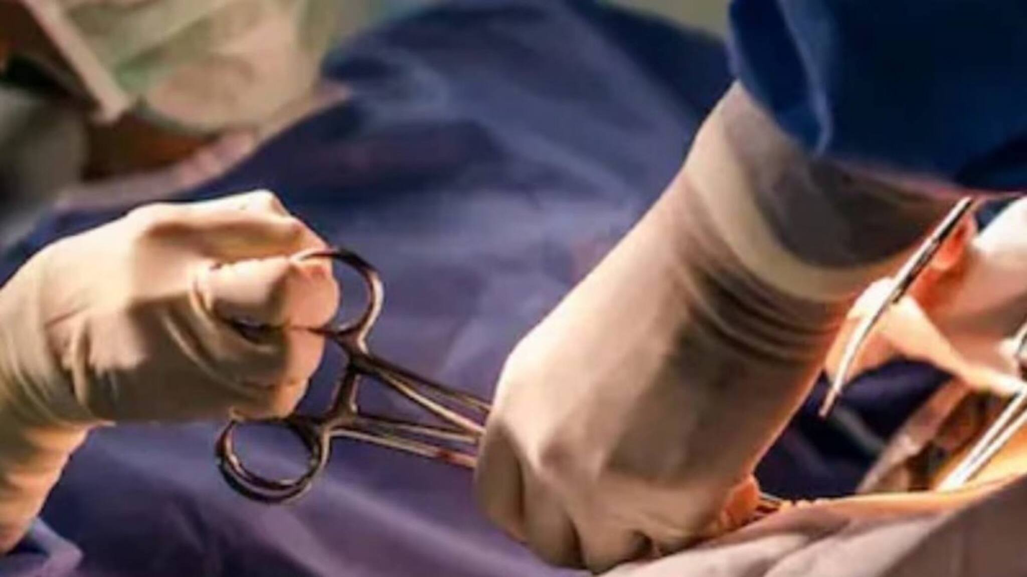 അറിയാതെ മലവും മൂത്രവും പോകുന്നു; 14കാരിക്ക് കോട്ടയം മെഡിക്കൽ കോളേജിൽ അപൂർവ ശസ്ത്രക്രിയ