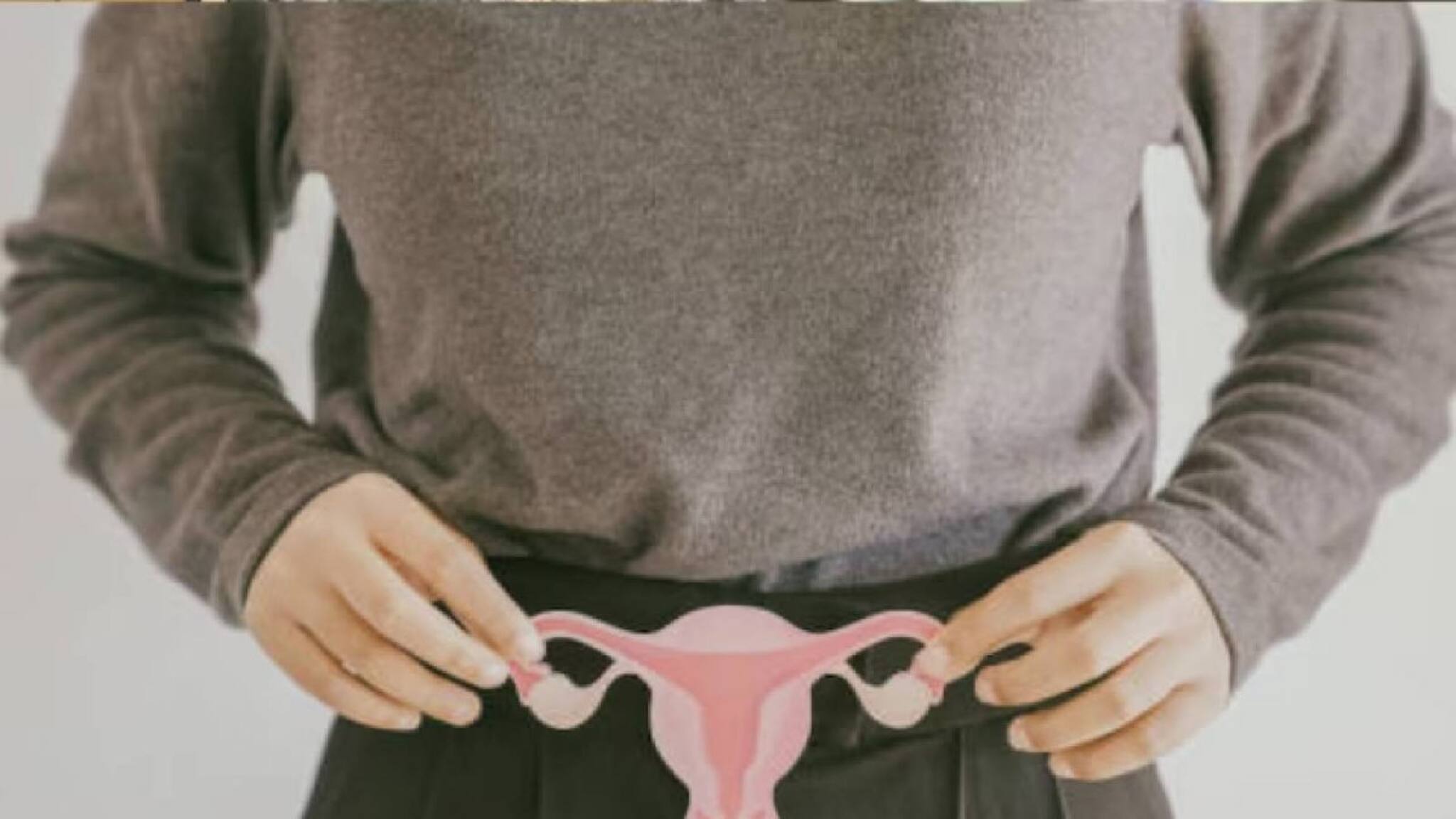 സ്ത്രീകളിൽ പിസിഒഎസ് മൂലമുള്ള ഹോർമോൺ വ്യതിയാനത്തിന്റെ അഞ്ച് പ്രധാന ലക്ഷണങ്ങൾ