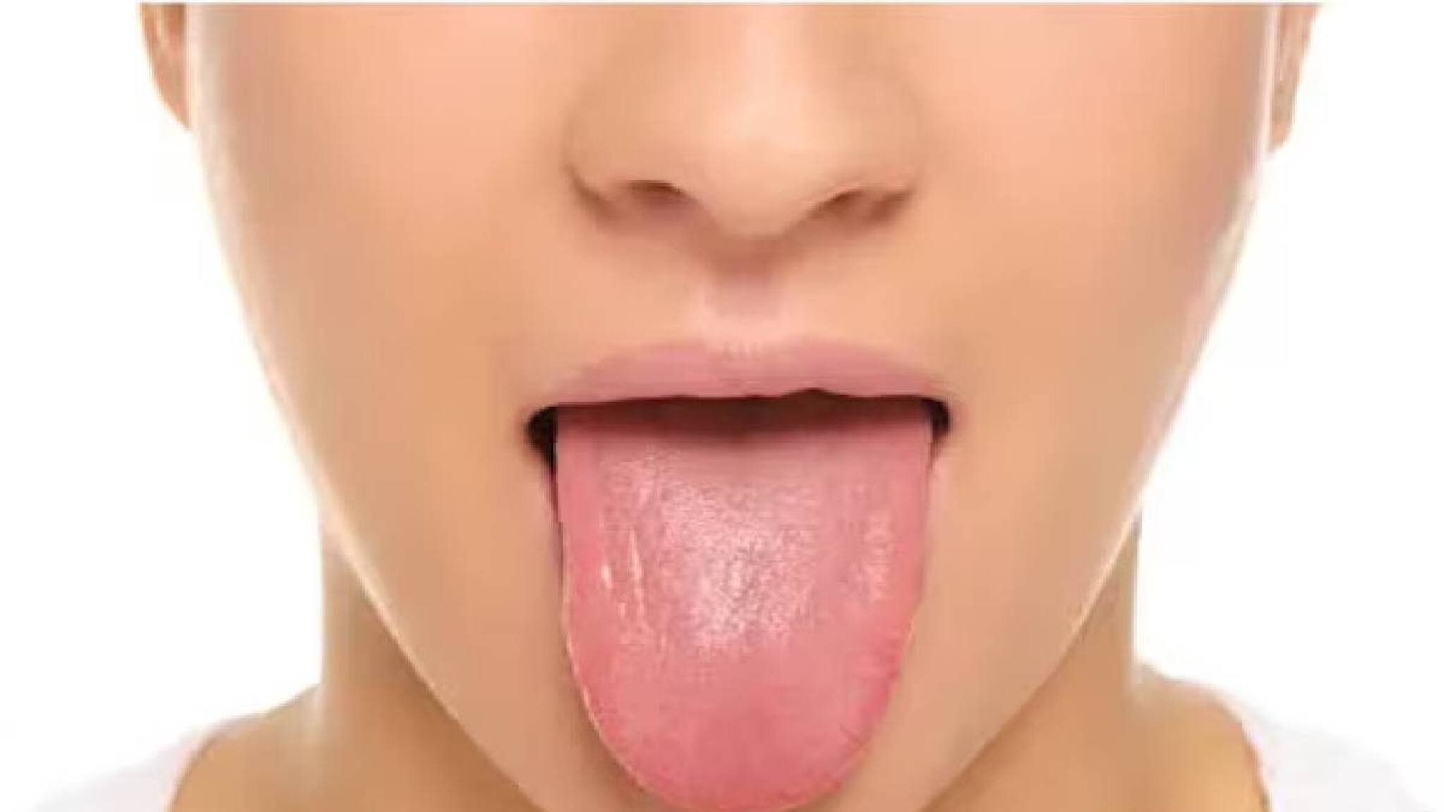 നാവ് നന്നായാൽ എല്ലാം നന്നാവും; നാവ് പരിശോധിച്ച് 98 ശതമാനം രോഗങ്ങളും കൃത്യമായി കണ്ടെത്തി എഐ മോഡല്‍