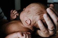 കുഞ്ഞുങ്ങള്‍ക്ക് ശരീരമാസകലം രോമം! മാതാപിതാക്കള്‍ മുടികൊഴിച്ചിലിനുള്ള മരുന്ന് കഴിച്ചിരുന്നതായി റിപ്പോര്‍ട്ട്