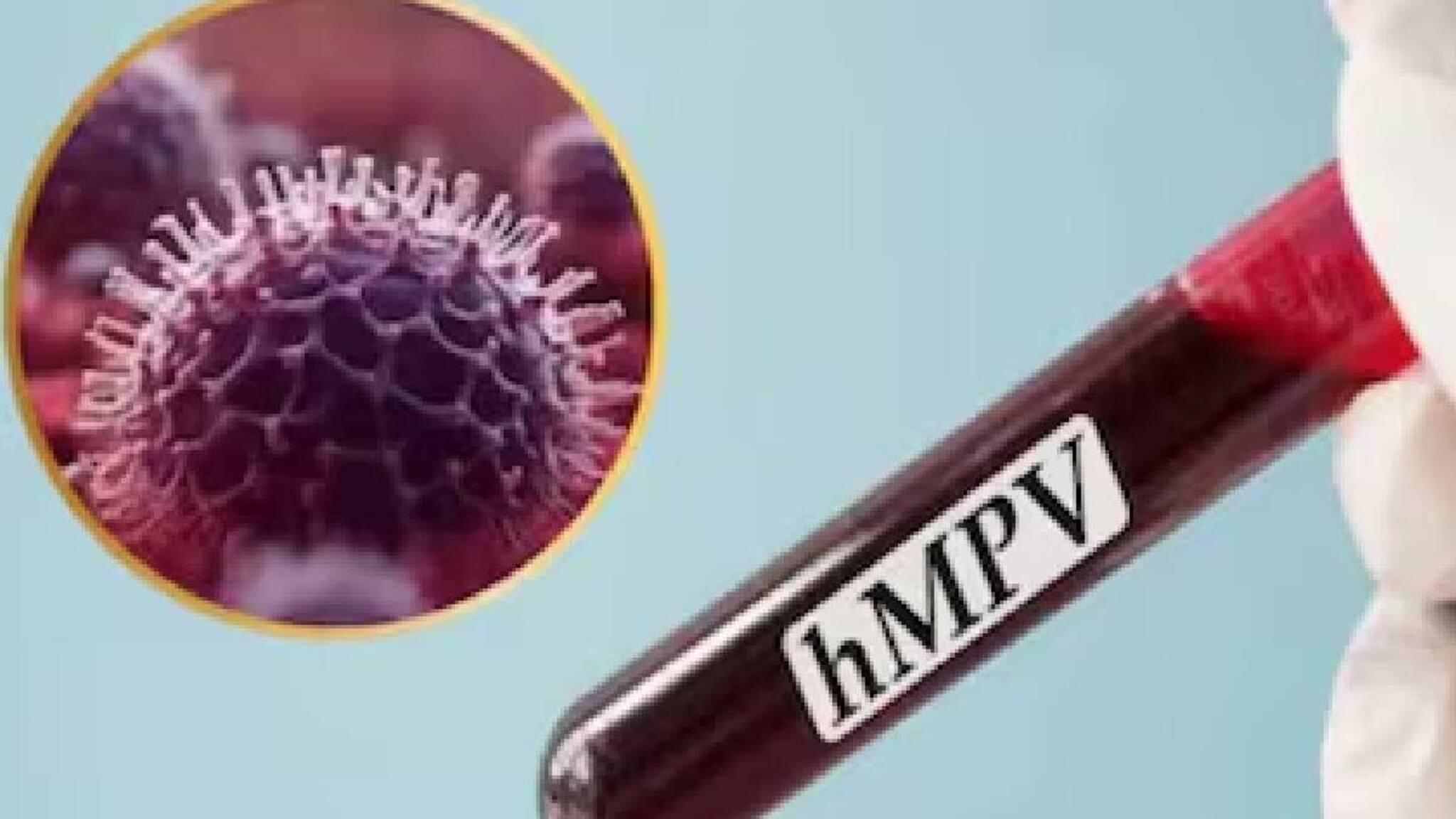 HMPV: എച്ച്എംപിവി ലക്ഷണങ്ങളും ചികിത്സയും; രോഗികളെ പരിപാലിക്കേണ്ടത് എങ്ങനെ?