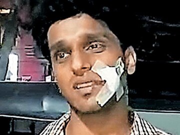 News18