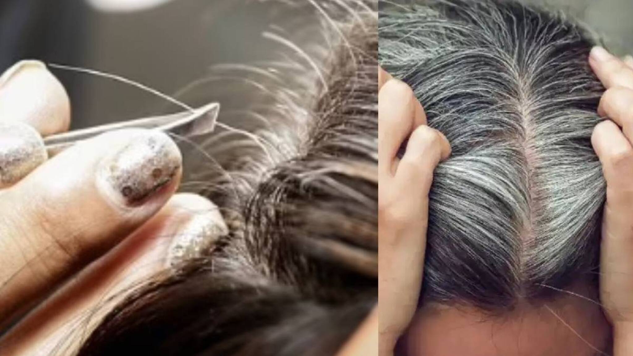 തലയിലെ നരച്ച മുടി പിഴുതാല്‍ കൂടുതല്‍ നരയ്ക്ക് കാരണമാകുമോ? സത്യാവസ്ഥ അറിയാം