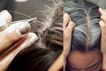 തലയിലെ നരച്ച മുടി പിഴുതാല്‍ കൂടുതല്‍ നരയ്ക്ക് കാരണമാകുമോ? സത്യാവസ്ഥ അറിയാം