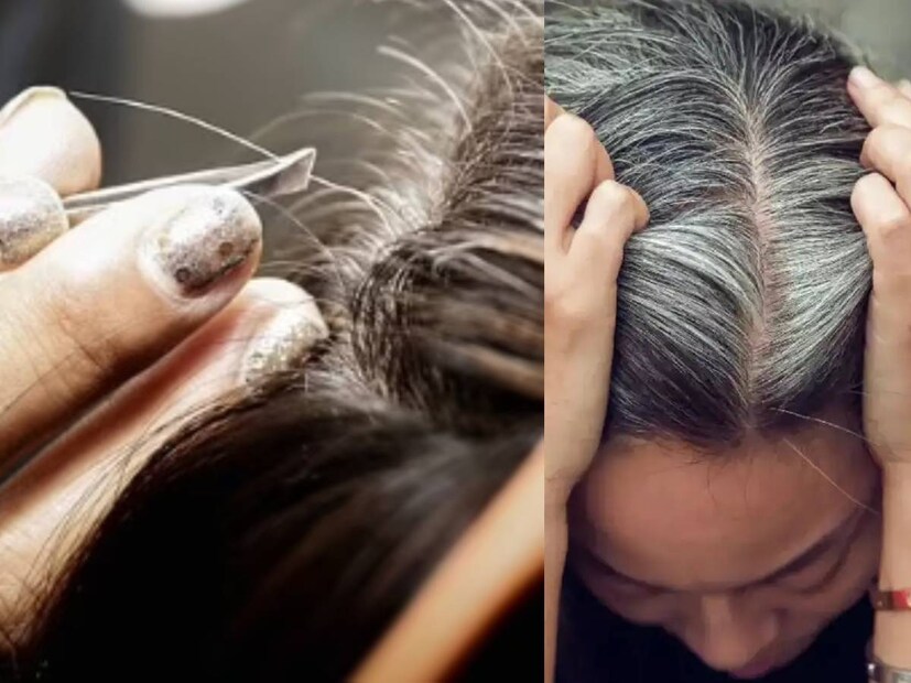 Gray hair, going gray, pluck your grays, pluck gray hair, gray hair myths, gray hair facts, what causes gray hair, how to cover gray hair, how to color gray hair, how to transition to gray hair, how to dye gray hair, best gray hair dyes, how to dye your hair gray, why does hair gray, plucking gray hair, best gray hair coverage, best hair dye for gray hair, grey hair, plucking grey hair, myth of plucking grey hair, does plucking grey hair increase grey hair, hair aging, genetics and grey hair, preventing grey hair, diet and grey hair, antioxidants and grey hair, vitamins and grey hair, hair care, hair health, does pulling out gray hair make more hair grayer, നരച്ച മുടി പിഴുതാല്‍, നരച്ച മുടി, മുടി നര, നരച്ച മുടി പിഴുതാല്‍,കൂടുതല്‍ നരയ്ക്ക് കാരണമാകുമോ,സത്യാവസ്ഥ അറിയാം ,നരച്ച മുടി,മുടി,തലയിലെ നരച്ച മുടി,മുടി പിഴുതാല്‍ ,അകാലനര, ഫിയോമെലാനോസൈറ്റുകള്‍, യൂമെലാനോസൈറ്റുകള്‍,മെലാനോസൈറ്റ്, ഹെൽത്ത് , ഹെൽത്ത് ന്യൂസ് 