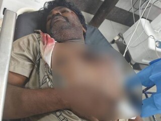 News18