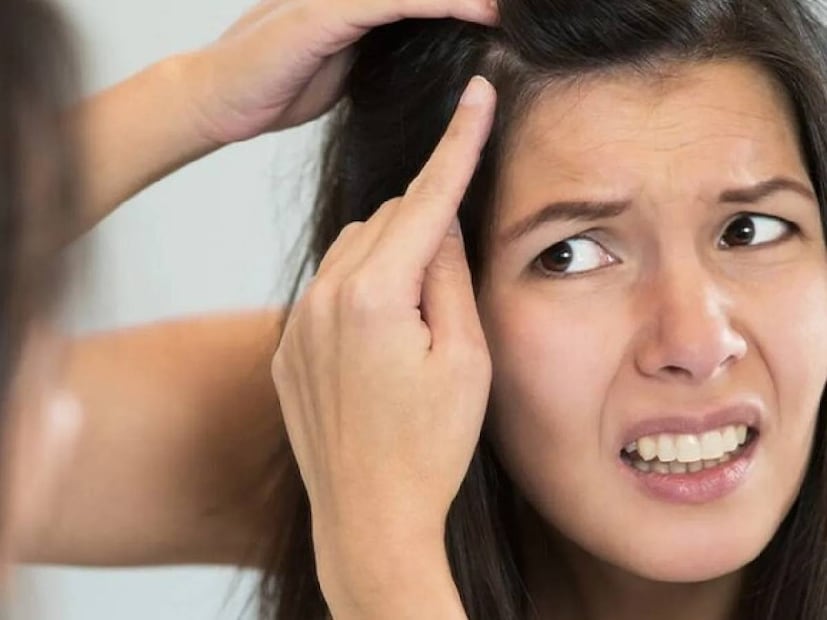 Gray hair, going gray, pluck your grays, pluck gray hair, gray hair myths, gray hair facts, what causes gray hair, how to cover gray hair, how to color gray hair, how to transition to gray hair, how to dye gray hair, best gray hair dyes, how to dye your hair gray, why does hair gray, plucking gray hair, best gray hair coverage, best hair dye for gray hair, grey hair, plucking grey hair, myth of plucking grey hair, does plucking grey hair increase grey hair, hair aging, genetics and grey hair, preventing grey hair, diet and grey hair, antioxidants and grey hair, vitamins and grey hair, hair care, hair health, does pulling out gray hair make more hair grayer, നരച്ച മുടി പിഴുതാല്‍, നരച്ച മുടി, മുടി നര, നരച്ച മുടി പിഴുതാല്‍,കൂടുതല്‍ നരയ്ക്ക് കാരണമാകുമോ,സത്യാവസ്ഥ അറിയാം ,നരച്ച മുടി,മുടി,തലയിലെ നരച്ച മുടി,മുടി പിഴുതാല്‍ ,അകാലനര, ഫിയോമെലാനോസൈറ്റുകള്‍, യൂമെലാനോസൈറ്റുകള്‍,മെലാനോസൈറ്റ്, ഹെൽത്ത് , ഹെൽത്ത് ന്യൂസ് 