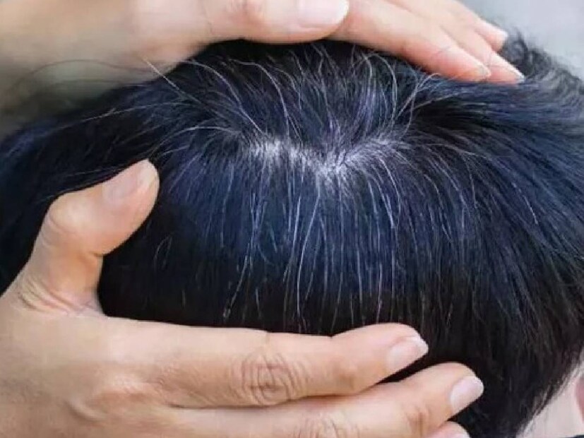Gray hair, going gray, pluck your grays, pluck gray hair, gray hair myths, gray hair facts, what causes gray hair, how to cover gray hair, how to color gray hair, how to transition to gray hair, how to dye gray hair, best gray hair dyes, how to dye your hair gray, why does hair gray, plucking gray hair, best gray hair coverage, best hair dye for gray hair, grey hair, plucking grey hair, myth of plucking grey hair, does plucking grey hair increase grey hair, hair aging, genetics and grey hair, preventing grey hair, diet and grey hair, antioxidants and grey hair, vitamins and grey hair, hair care, hair health, does pulling out gray hair make more hair grayer, നരച്ച മുടി പിഴുതാല്‍, നരച്ച മുടി, മുടി നര, നരച്ച മുടി പിഴുതാല്‍,കൂടുതല്‍ നരയ്ക്ക് കാരണമാകുമോ,സത്യാവസ്ഥ അറിയാം ,നരച്ച മുടി,മുടി,തലയിലെ നരച്ച മുടി,മുടി പിഴുതാല്‍ ,അകാലനര, ഫിയോമെലാനോസൈറ്റുകള്‍, യൂമെലാനോസൈറ്റുകള്‍,മെലാനോസൈറ്റ്, ഹെൽത്ത് , ഹെൽത്ത് ന്യൂസ് 