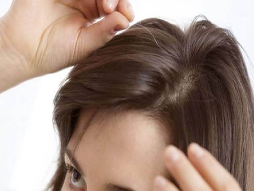 Gray hair, going gray, pluck your grays, pluck gray hair, gray hair myths, gray hair facts, what causes gray hair, how to cover gray hair, how to color gray hair, how to transition to gray hair, how to dye gray hair, best gray hair dyes, how to dye your hair gray, why does hair gray, plucking gray hair, best gray hair coverage, best hair dye for gray hair, grey hair, plucking grey hair, myth of plucking grey hair, does plucking grey hair increase grey hair, hair aging, genetics and grey hair, preventing grey hair, diet and grey hair, antioxidants and grey hair, vitamins and grey hair, hair care, hair health, does pulling out gray hair make more hair grayer, നരച്ച മുടി പിഴുതാല്‍, നരച്ച മുടി, മുടി നര, നരച്ച മുടി പിഴുതാല്‍,കൂടുതല്‍ നരയ്ക്ക് കാരണമാകുമോ,സത്യാവസ്ഥ അറിയാം ,നരച്ച മുടി,മുടി,തലയിലെ നരച്ച മുടി,മുടി പിഴുതാല്‍ ,അകാലനര, ഫിയോമെലാനോസൈറ്റുകള്‍, യൂമെലാനോസൈറ്റുകള്‍,മെലാനോസൈറ്റ്, ഹെൽത്ത് , ഹെൽത്ത് ന്യൂസ് 