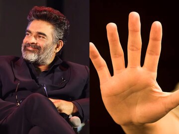 നിങ്ങളുടെ വിരലിലേക്ക് ഒന്ന് നോക്കിയേ; മൊബൈൽ ഫോൺ ഉപയോഗിക്കുന്നവരുടെ കൈ ഇങ്ങനെ: നടൻ മാധവൻ നിങ്ങളുടെ വിരലിലേക്ക് ഒന്ന് നോക്കിയേ; മൊബൈൽ ഫോൺ ഉപയോഗിക്കുന്നവരുടെ കൈ ഇങ്ങനെ: നടൻ മാധവൻ