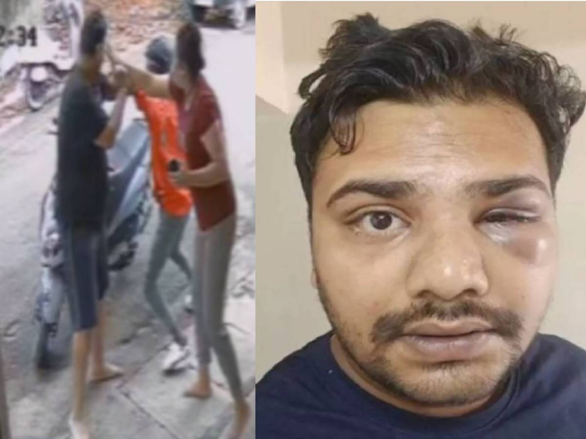 ലൊക്കേഷന്‍ തെറ്റായി നൽകിയ ഉപഭോക്താവിന്റെ തല ഡെലിവറി ബോയ് തല്ലി പൊട്ടിച്ചു