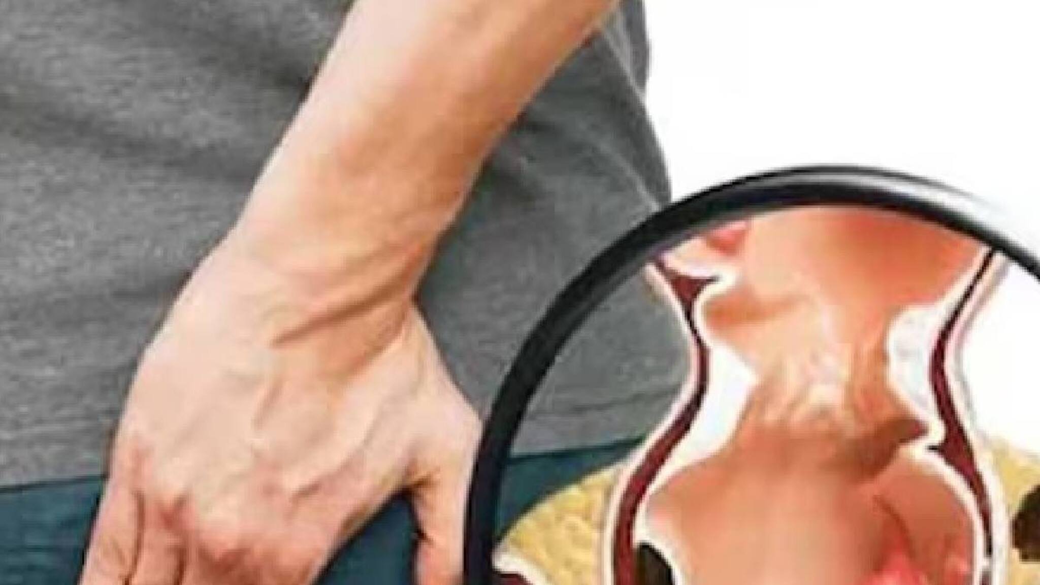 Piles| ഇടയ്ക്കിടെ ടോയ്‌ലറ്റില്‍ പോകാന്‍ തോന്നാറുണ്ടോ? ശ്രദ്ധിക്കുക ഇത് പൈൽസിന്റെ ലക്ഷണമാവാം!