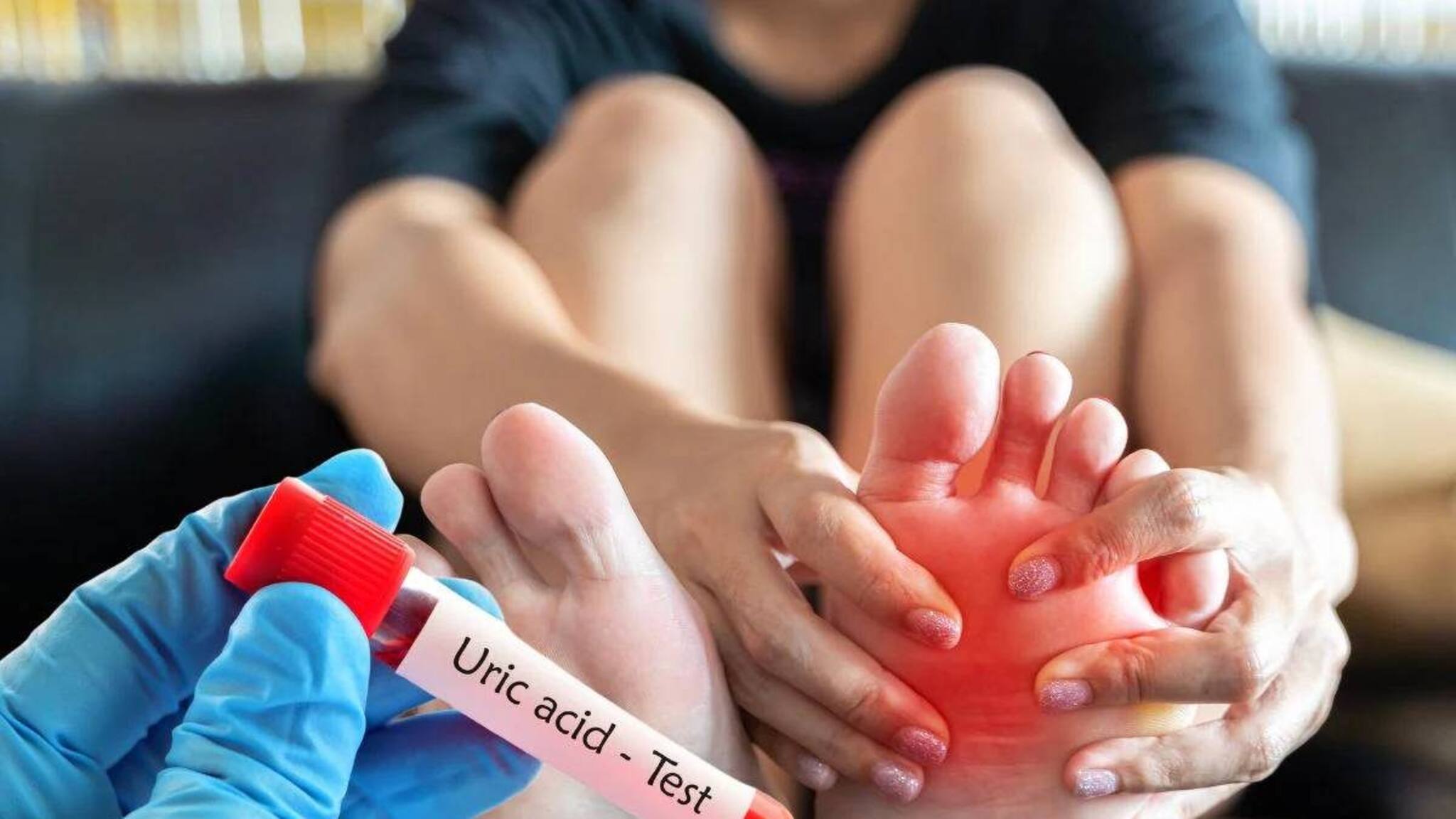 Uric Acid| വേനൽക്കാലത്ത് യൂറിക് ആസിഡ് കൂടുമോ? നമ്മുടെ ശരീരത്തിന് എന്ത് സംഭവിക്കും?