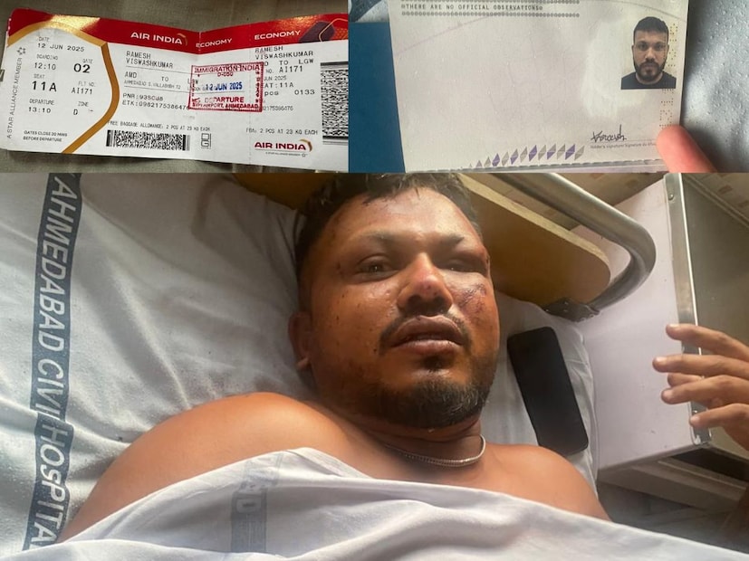  പിന്നീട് നോക്കുമ്പോൾ ചുറ്റിലും മൃതദേ​ഹങ്ങളായിരുന്നുവെന്നുമാണ് ദുരന്തത്തെക്കുറിച്ച് വിശ്വാസ് കുമാറിൻ്റെ പ്രതികരണം. ഇയാൾ ഇപ്പോൾ അഹമ്മദാബാദ് സിവിൽ ആശുപത്രിയിൽ ചികിത്സയിലാണെന്ന് അഹമ്മദാബാദ് സി.പി. ജി.എസ്. മാലിക് പറഞ്ഞു.