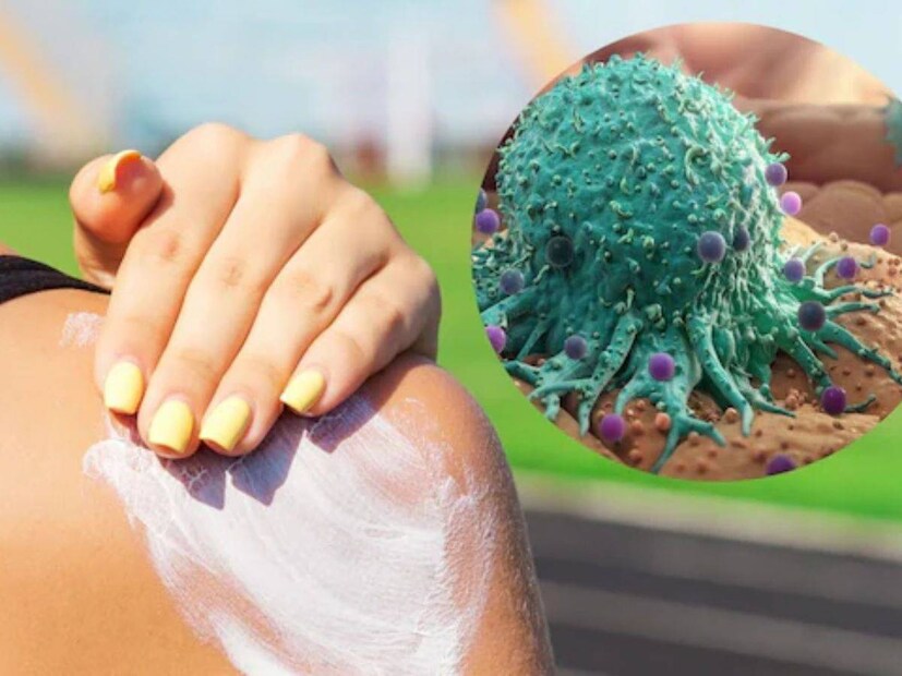 side effects of sunscreen, negative effects of sunscreen, negative impact of sunscreen, why shouldn't you use sunscreen, basic skincare, skincare tips, sunscreen, sunscreen for skin,fun in the sun, Sunscreen, Tanning, Skin Care, Skin types, sunscreen myths, dermatologists, best skincare for oily skin, best skincare brands, tips for clear skin, how to get healthy skin, best sunscreen for face, സൺസ്‌ക്രീൻ, പാർശ്വഫലങ്ങൾ , അലർജി മുതൽ, സ്തനാർബുദം ,കാര്യങ്ങൾ അറിഞ്ഞിരിക്കണം,സൺസ്‌ക്രീൻ ഗുണങ്ങൾ , സൺസ്‌ക്രീൻ നെഗറ്റീവ് വശങ്ങൾ , സൺസ്‌ക്രീൻ ബ്രാൻഡ് ,സൺസ്‌ക്രീൻ വില , സൺസ്‌ക്രീൻ ടിപ്സ് 