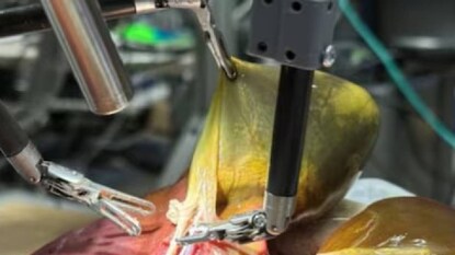 (Image: Juo-Tung Chen/Johns Hopkins University) (Image: Juo-Tung Chen/Johns Hopkins University)