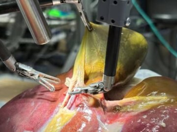 (Image: Juo-Tung Chen/Johns Hopkins University)