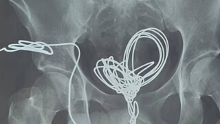 യുവാവ് ഇത് ചെയ്തതിന്റെ കാരണം വ്യക്തമല്ലെന്ന് അധികൃതര് പറഞ്ഞു യുവാവ് ഇത് ചെയ്തതിന്റെ കാരണം വ്യക്തമല്ലെന്ന് അധികൃതര് പറഞ്ഞു