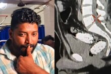 കൊല്ലത്ത് മലദ്വാരത്തിൽ ഒളിപ്പിച്ച് എംഡിഎംഎ കടത്തിയ യുവാവ് പിടിയിൽ