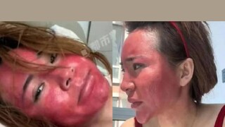 മേക്കപ്പ് ഉപയോഗിച്ച യുവതി