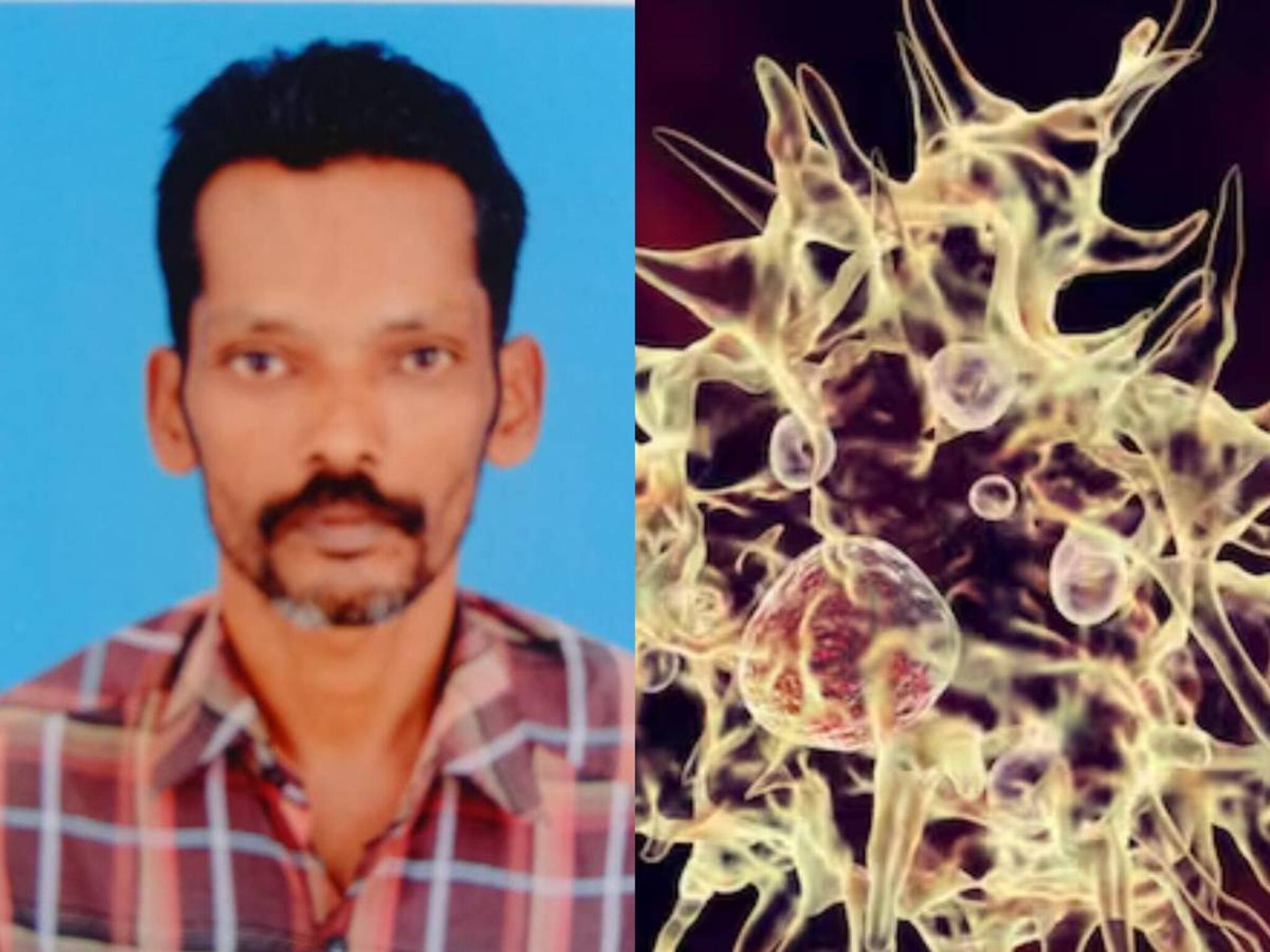 അമീബിക് മസ്തിഷ്‌ക ജ്വരം ബാധിച്ച് ഒരാൾ കൂടി മരിച്ചു; ഒരുമാസത്തിനിടെ മരിച്ചത് ആറുപേര്‍