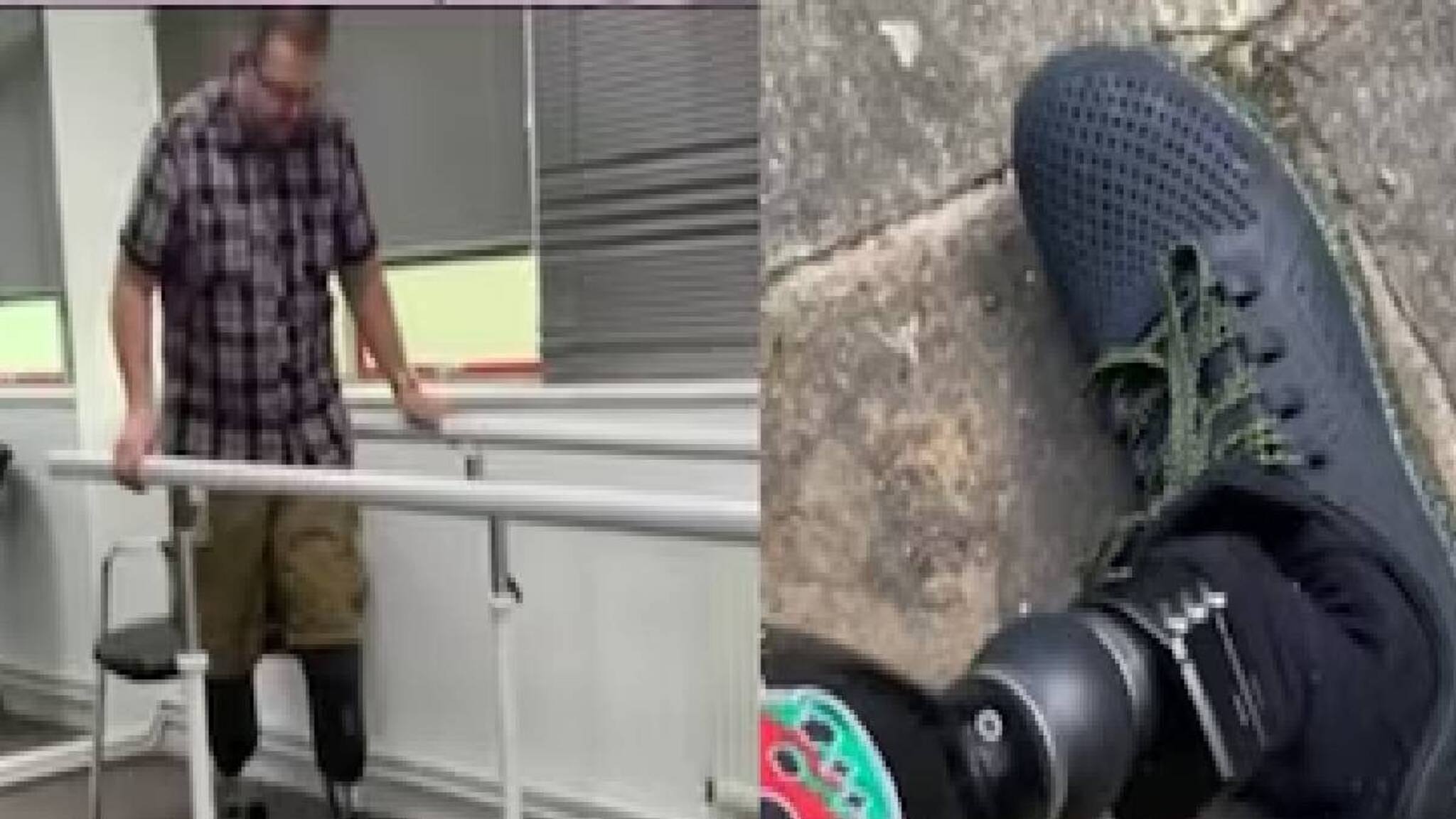 ലൈംഗികാഭിലാഷം പൂർത്തിയാക്കാൻ സ്വന്തം കാലുകൾ മുറിച്ചുമാറ്റിയ സർജൻ അഞ്ച് കോടി രൂപയുടെ ഇൻഷുറൻസ് തട്ടിയെടുത്തു