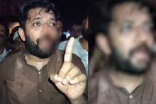 കോഴിക്കോട് സിപിഎം-കോണ്‍ഗ്രസ് സംഘര്‍ഷം; ഷാഫി പറമ്പില്‍ എം.പിക്ക് പരിക്ക്