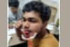 കോഴിക്കോട് ട്രെയിനില്‍ നിന്നും വലിച്ചെറിഞ്ഞ മദ്യക്കുപ്പിവീണ് കാല്‍നട യാത്രക്കാരന് പരിക്ക്