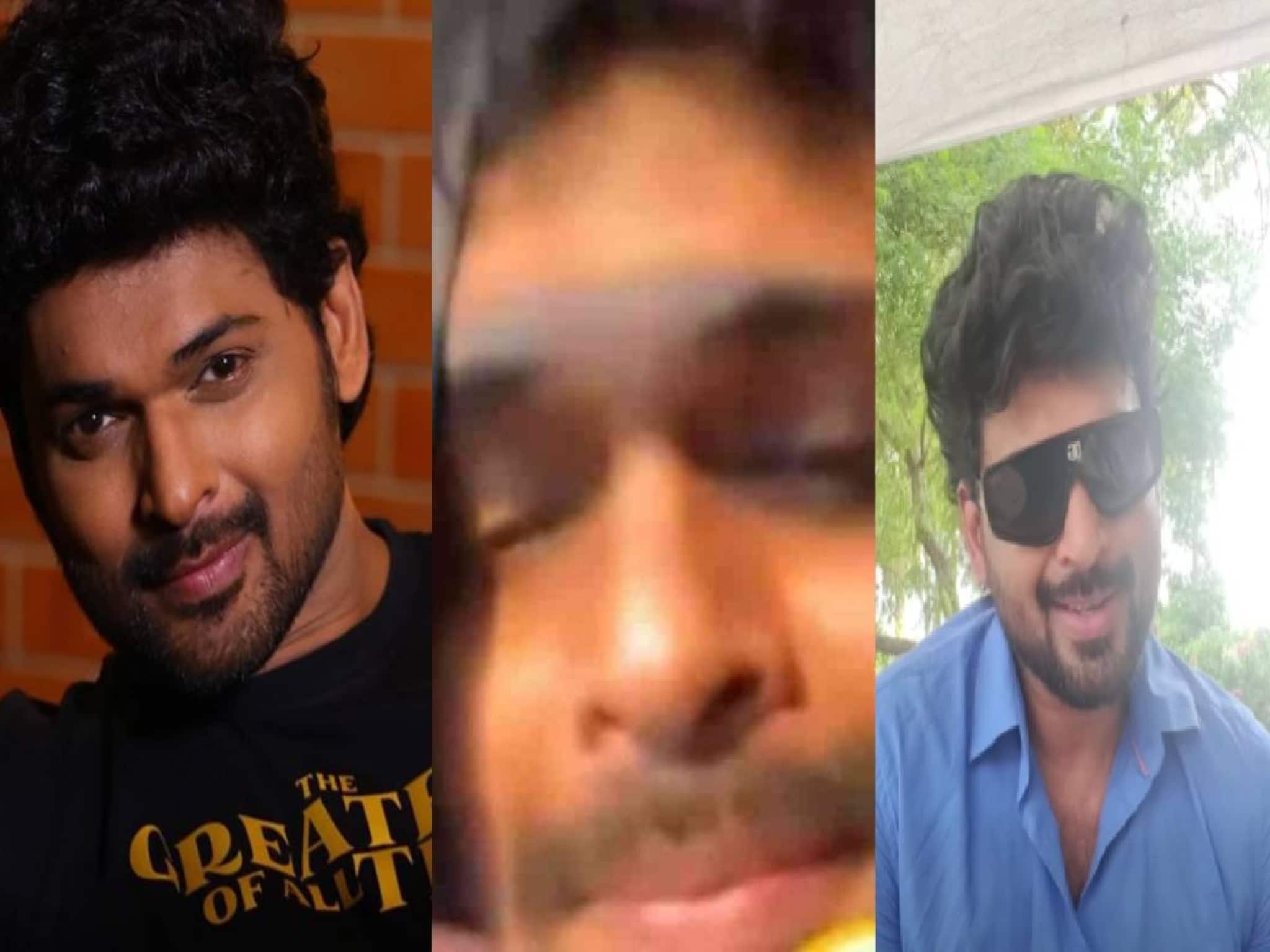 'സെക്സ് ചാറ്റ് ആരോപണം വ്യാജം; AI വോയ്‌സിന് എന്റെ കരിയർ നശിപ്പിക്കാൻ കഴിയില്ല': നടൻ അജ്മൽ അമീർ