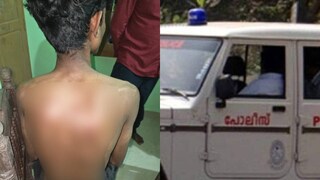 മര്‍ദനമേറ്റ വിദ്യാർത്ഥി