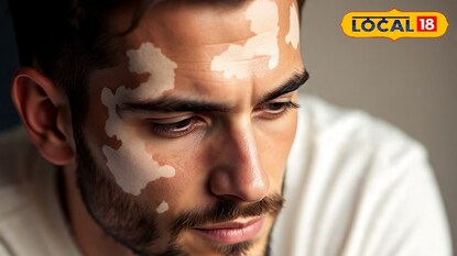 രോഗബാധിതൻ; പ്രതീകാത്മക ചിത്രം രോഗബാധിതൻ; പ്രതീകാത്മക ചിത്രം