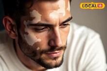 ഈ രോഗത്തിന് തിരുവനന്തപുരത്ത് സൗജന്യ ചികിത്സയുണ്ട്... നിങ്ങളിൽ എത്രപേർക്കറിയാം?