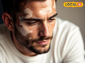 രോഗബാധിതൻ; പ്രതീകാത്മക ചിത്രം