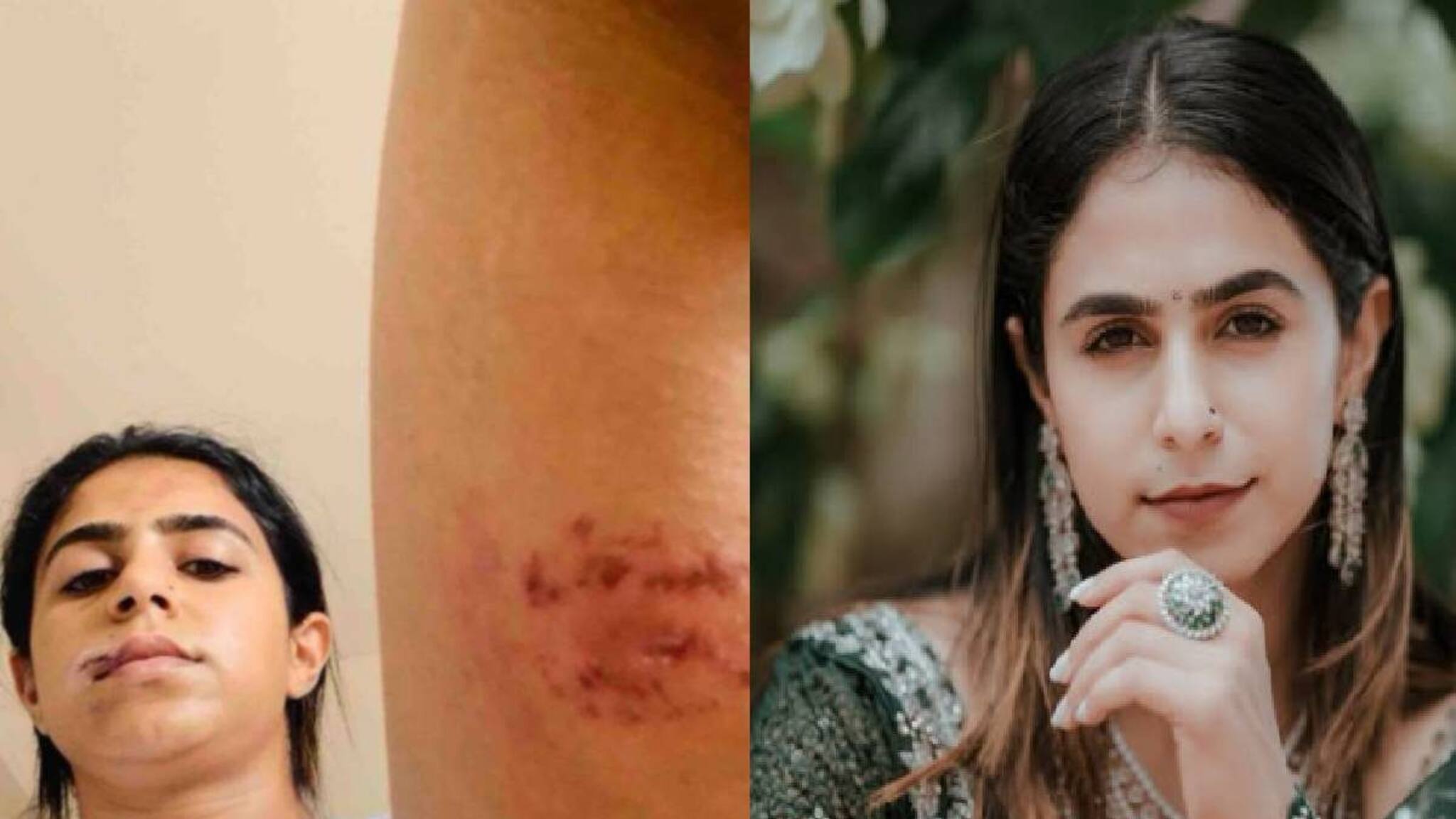 'മുൻ പങ്കാളി വളയുപയോ​ഗിച്ച് മുഖത്തടിച്ചു; മേൽ ചുണ്ട് കീറിപോയി': വെളിപ്പെടുത്തലുമായി നടി ജസീല പർവീൺ