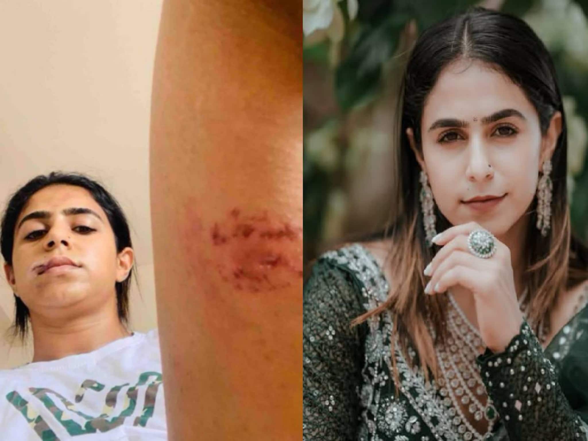 'മുൻ പങ്കാളി വളയുപയോ​ഗിച്ച് മുഖത്തടിച്ചു; മേൽ ചുണ്ട് കീറിപോയി': വെളിപ്പെടുത്തലുമായി നടി ജസീല പർവീൺ