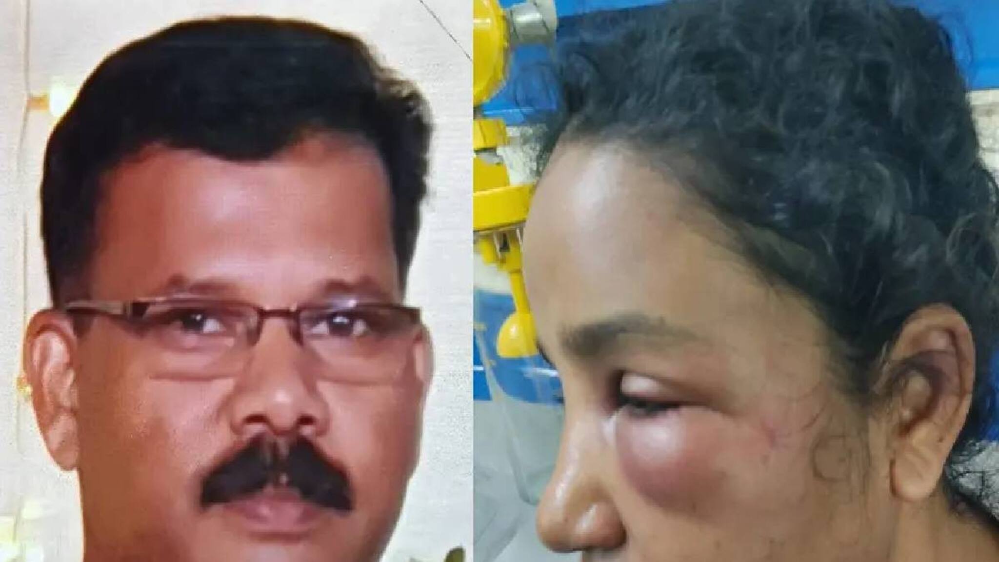 ഒഴിഞ്ഞുപോകണമെന്ന് ആവശ്യപ്പെട്ട് മർദനം; കോട്ടയത്ത് ഭർത്താവിനെതിരെ യുവതിയുടെ പരാതി