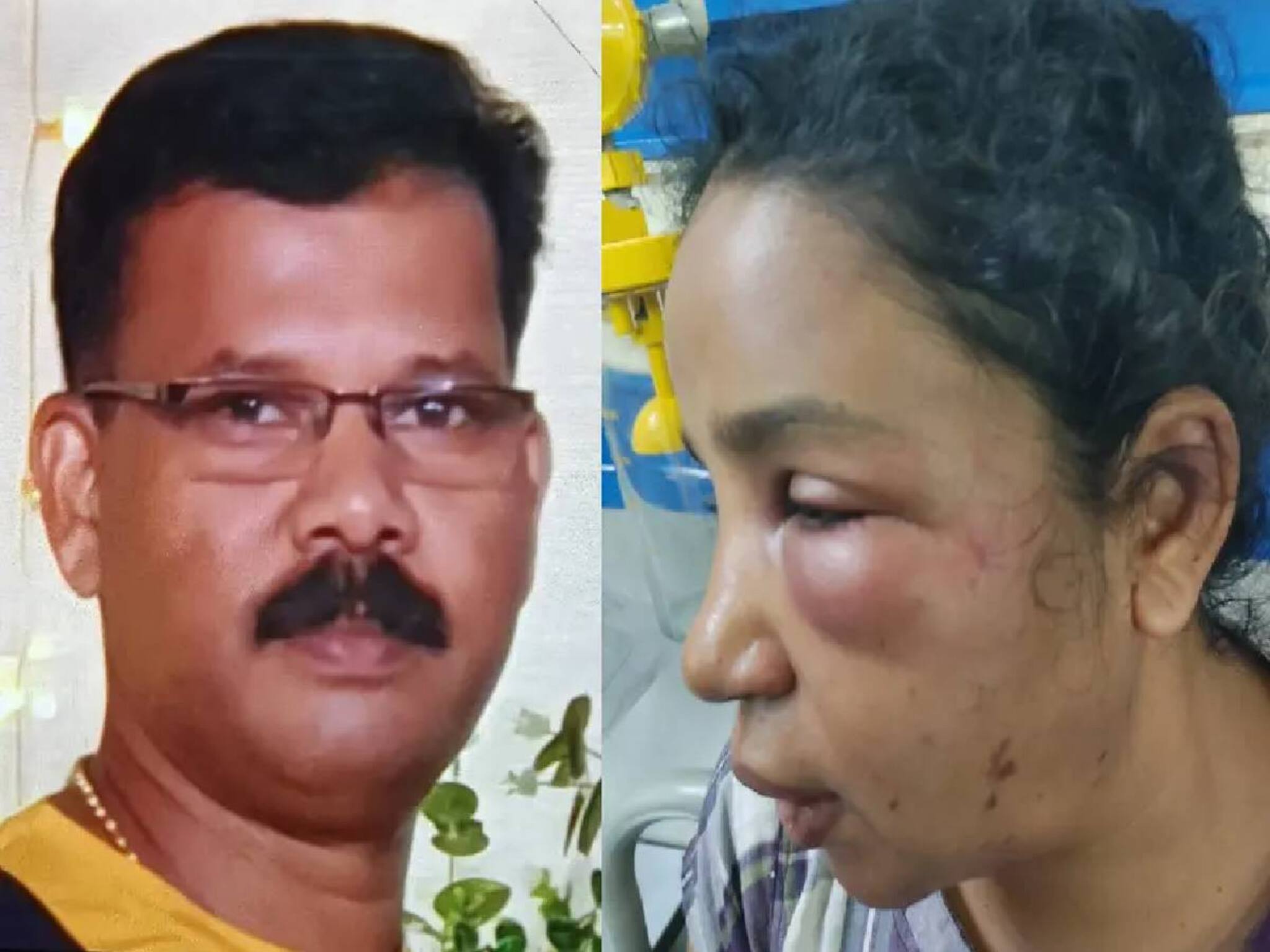 ഒഴിഞ്ഞുപോകണമെന്ന് ആവശ്യപ്പെട്ട് മർദനം; കോട്ടയത്ത് ഭർത്താവിനെതിരെ യുവതിയുടെ പരാതി