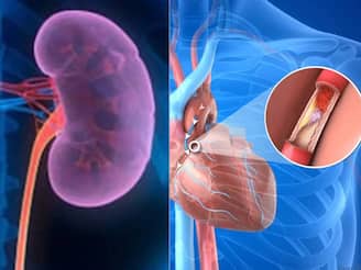 നാല് വർഷങ്ങൾക്ക് മുൻപ് വൃക്ക മാറ്റിവച്ച രോഗിയിൽ നൂതന ബൈപ്പാസ് ശസ്ത്രക്രിയ വിജയകരമാക്കി കിംസ് ഹെൽത്ത്