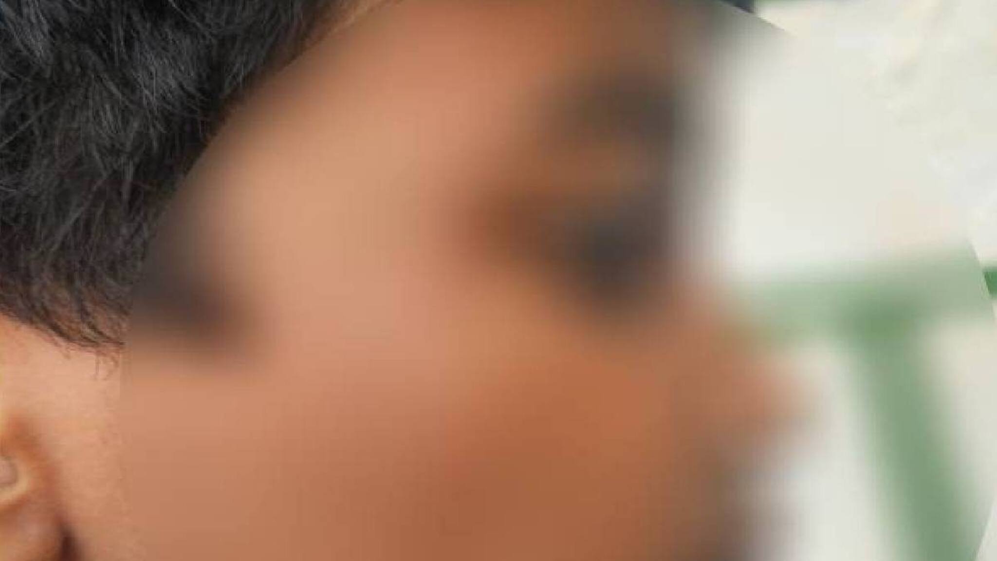 വയനാട്ടില്‍ ചികിത്സയ്ക്കിടെ ഡോക്ടര്‍ ഏഴ് വയസുകാരന്റെ മുഖത്തടിച്ചതായി പരാതി