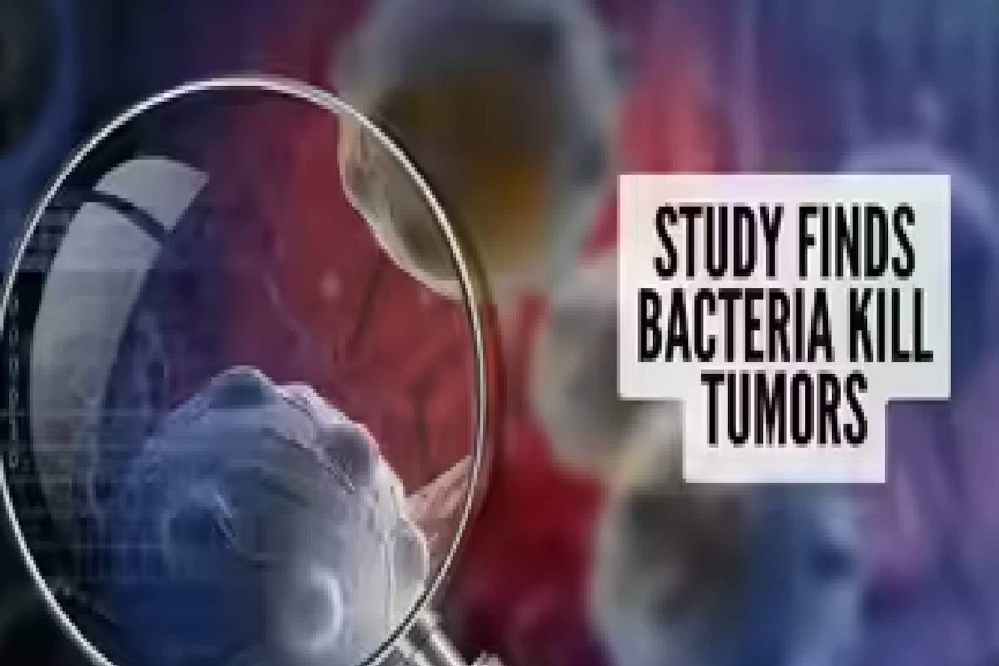ബാക്ടീരിയകള് മരുന്നുകളേക്കാള് ഫലപ്രദമായി കാന്സര് കോശങ്ങളെ നശിപ്പിക്കുന്നുവെന്ന് പഠനം ബാക്ടീരിയകള് മരുന്നുകളേക്കാള് ഫലപ്രദമായി കാന്സര് കോശങ്ങളെ നശിപ്പിക്കുന്നുവെന്ന് പഠനം