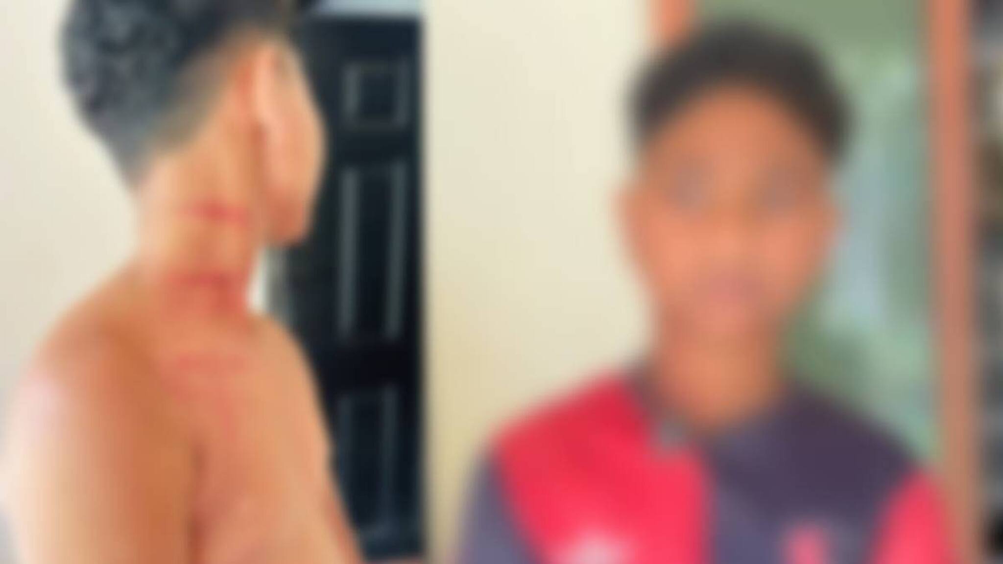 ചെരുപ്പ് മാറി ഇട്ടത് ചോദിച്ച ആദിവാസി വിദ്യാർത്ഥിക്ക് സീനിയർ വിദ്യാർ‌ത്ഥിയുടെ ക്രൂര മർദനം