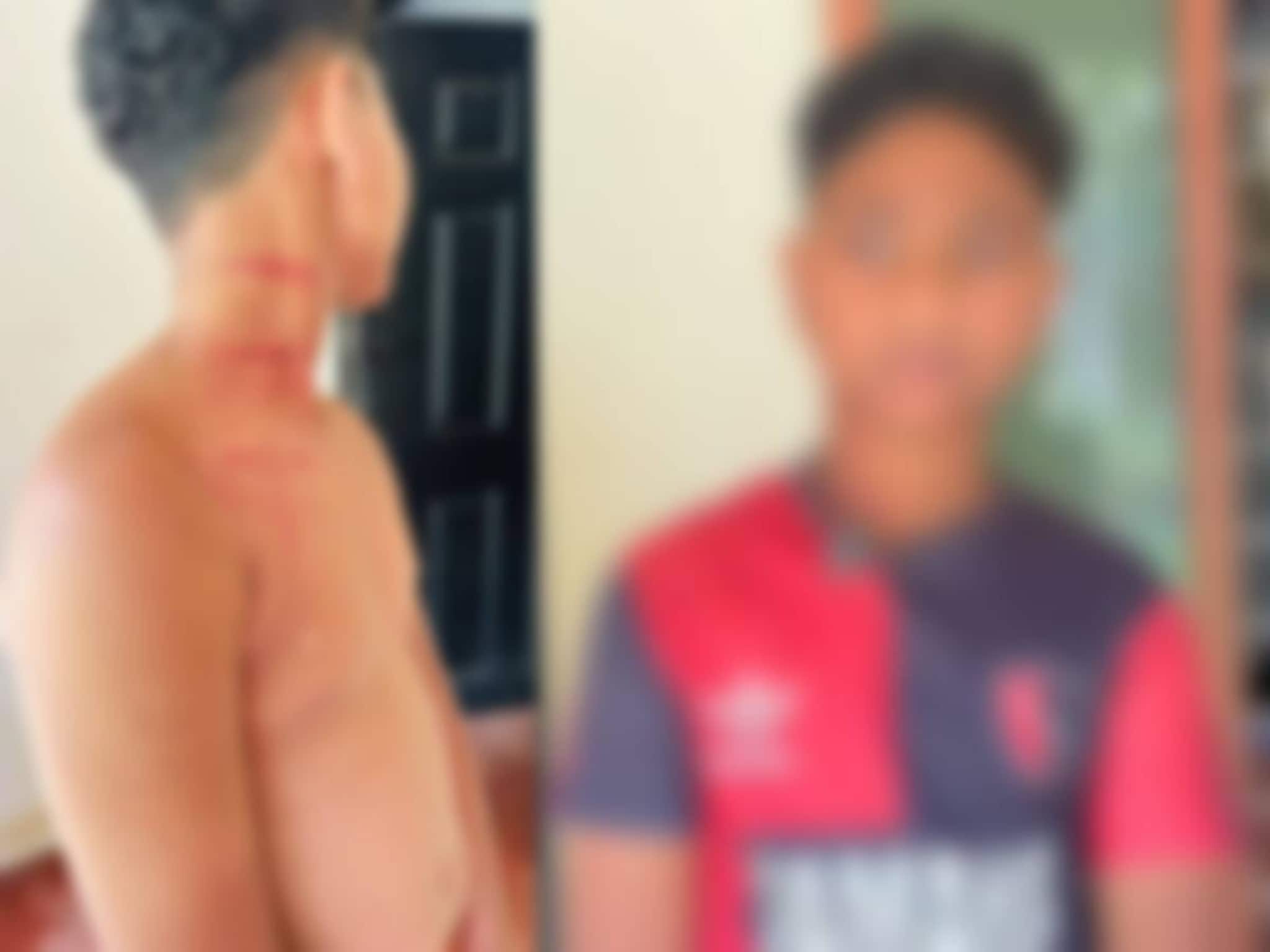 ചെരുപ്പ് മാറി ഇട്ടത് ചോദിച്ച ആദിവാസി വിദ്യാർത്ഥിക്ക് സീനിയർ വിദ്യാർത്ഥിയുടെ ക്രൂര മർദനം ചെരുപ്പ് മാറി ഇട്ടത് ചോദിച്ച ആദിവാസി വിദ്യാർത്ഥിക്ക് സീനിയർ വിദ്യാർത്ഥിയുടെ ക്രൂര മർദനം