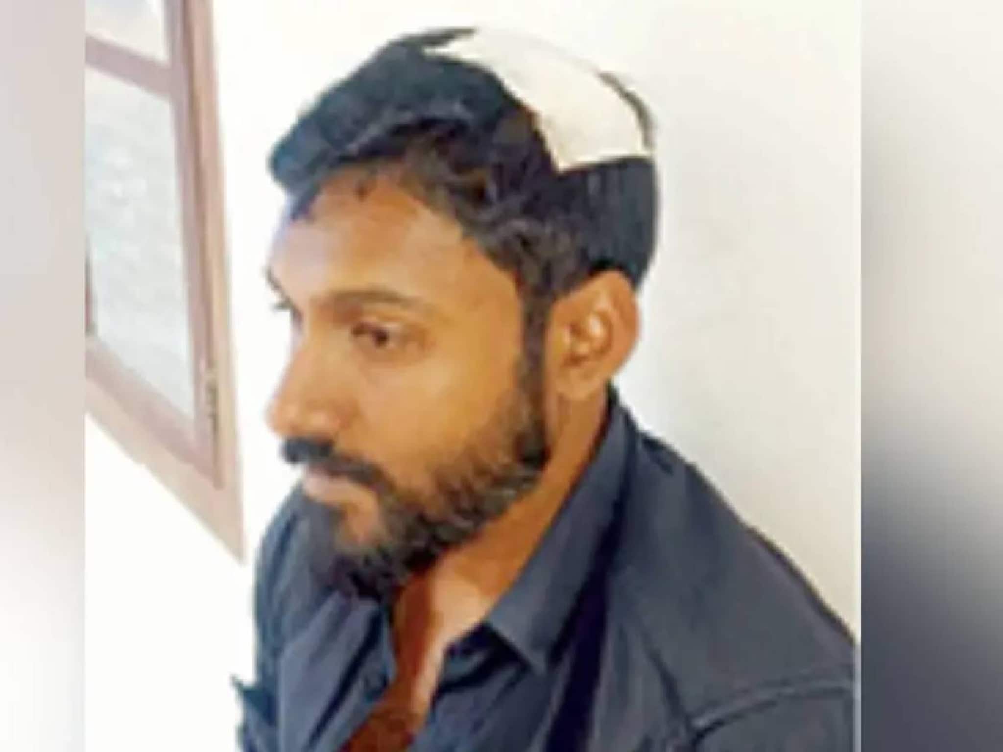 കോഴിക്കോട് പഞ്ചായത്ത് പാർക്കിൽ ഊഞ്ഞാൽ പൊട്ടിവീണ് യുവാവിന്റെ തലയ്ക്ക് ഒൻപത് തുന്നൽ കോഴിക്കോട് പഞ്ചായത്ത് പാർക്കിൽ ഊഞ്ഞാൽ പൊട്ടിവീണ് യുവാവിന്റെ തലയ്ക്ക് ഒൻപത് തുന്നൽ