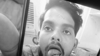 വിപിന്റെ നാക്കിന്റെ ഭാഗം കടിച്ചെടുത്ത നിലയിൽ