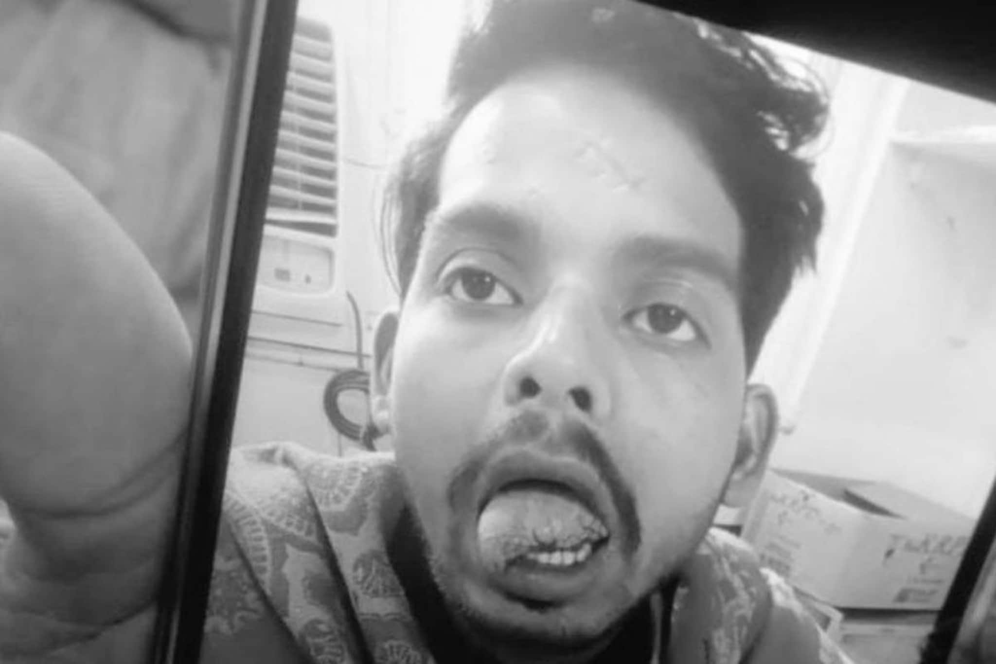 മുട്ടക്കറിയെച്ചൊല്ലിയുണ്ടായ വഴക്കിൽ ഭാര്യ ഭർത്താവിന്റെ നാക്ക് കടിച്ചുമുറിച്ചു