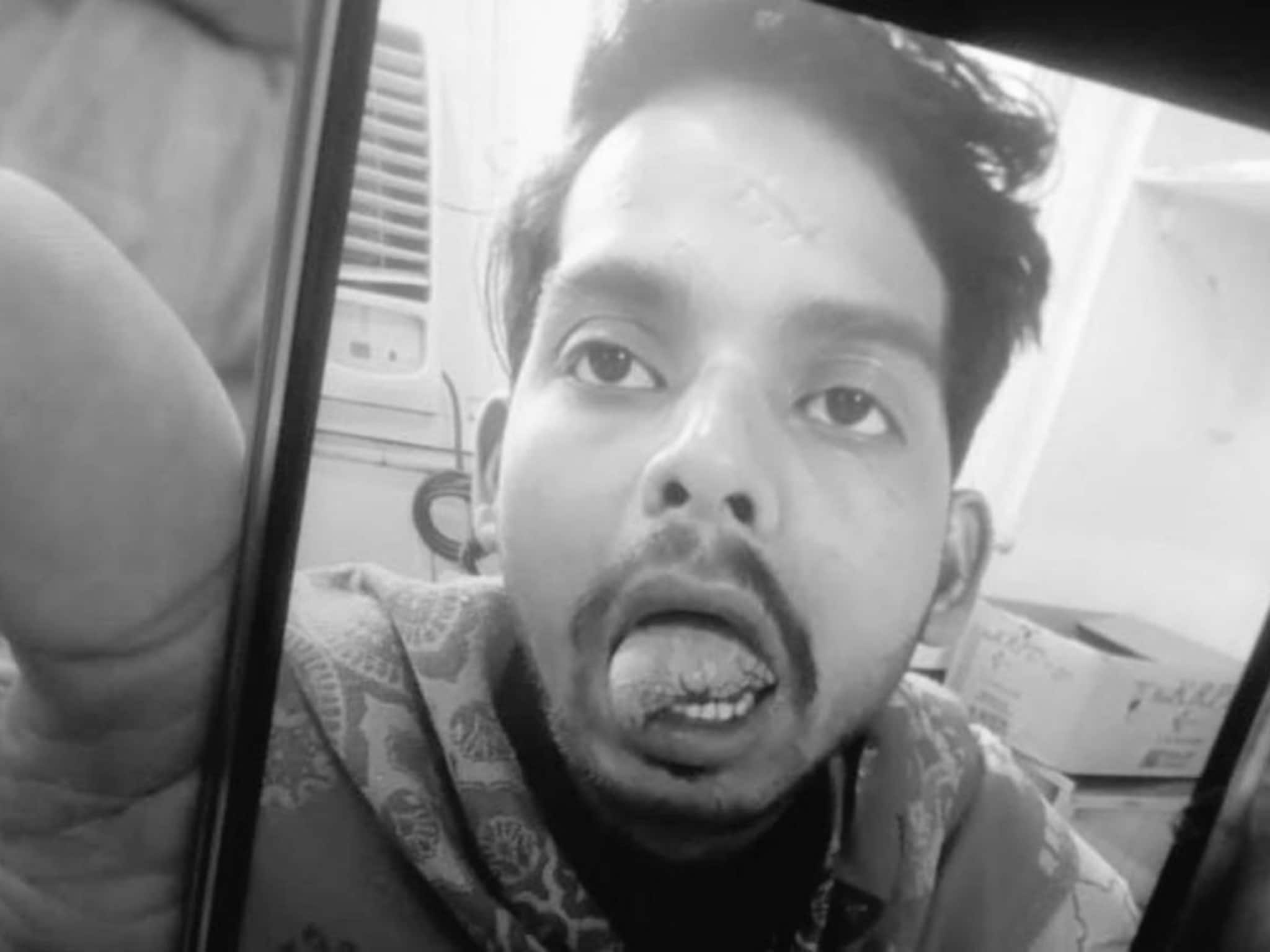 മുട്ടക്കറിയെച്ചൊല്ലിയുണ്ടായ വഴക്കിൽ ഭാര്യ ഭർത്താവിന്റെ നാക്ക് കടിച്ചുമുറിച്ചു