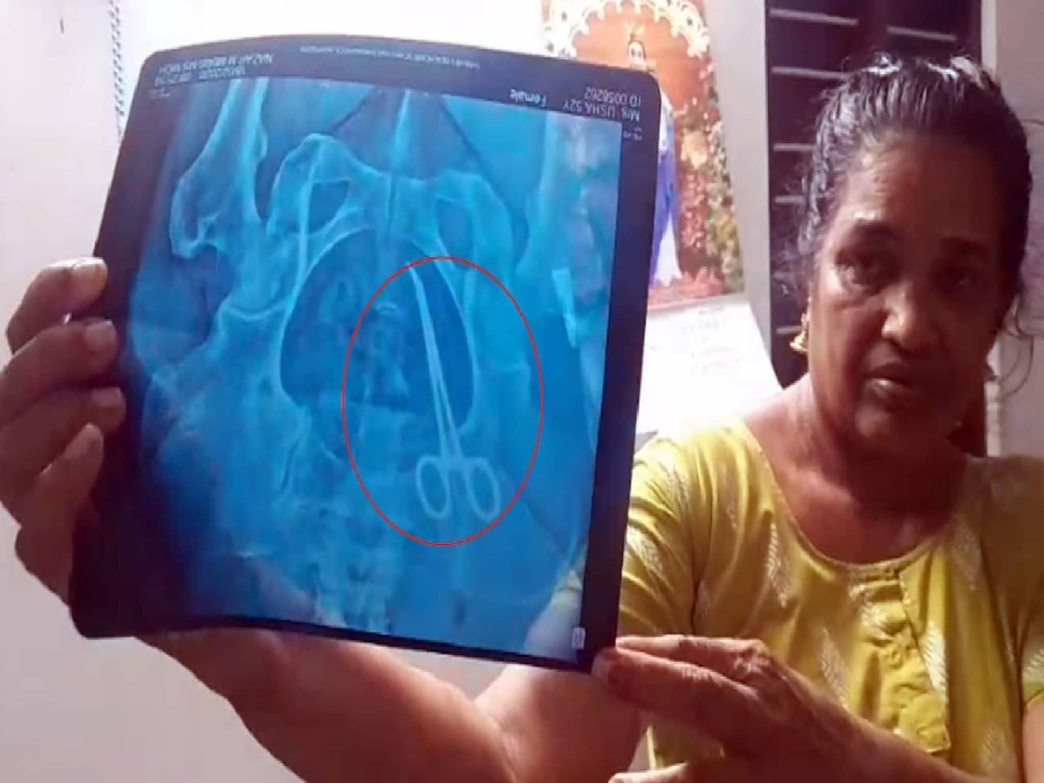 5 വർഷം മുമ്പത്തെ ശസ്ത്രക്രിയക്ക് പിന്നാലെ വീട്ടമ്മയ്ക്ക് വയറുവേദന; സ്കാനിങ്ങിൽ വയറ്റിൽ ശസ്ത്രക്രിയാ ഉപകരണം 5 വർഷം മുമ്പത്തെ ശസ്ത്രക്രിയക്ക് പിന്നാലെ വീട്ടമ്മയ്ക്ക് വയറുവേദന; സ്കാനിങ്ങിൽ വയറ്റിൽ ശസ്ത്രക്രിയാ ഉപകരണം