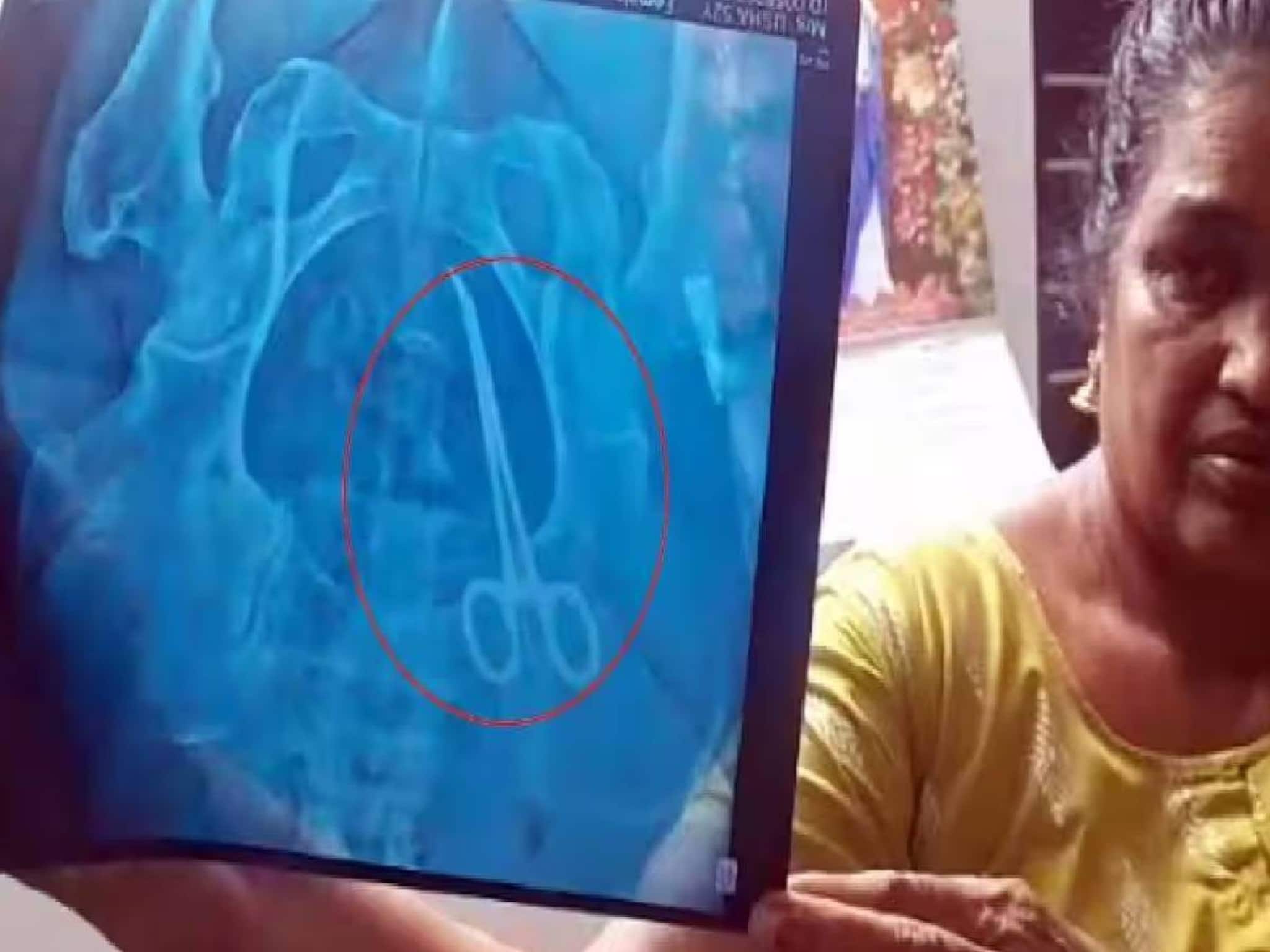 വയറ്റിൽ കത്രിക: ആരെയും കുറ്റപ്പെടുത്താൻ ഉപയോഗിക്കരുത്; കുറവുകൾ പരിഹരിക്കാൻ മുന്നറിയിപ്പായി കാണണം: KGMCTA വയറ്റിൽ കത്രിക: ആരെയും കുറ്റപ്പെടുത്താൻ ഉപയോഗിക്കരുത്; കുറവുകൾ പരിഹരിക്കാൻ മുന്നറിയിപ്പായി കാണണം: KGMCTA