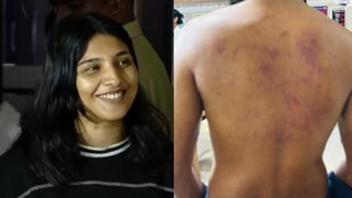 സഫ്ന, പരിക്കേറ്റ യുവാവ് സഫ്ന, പരിക്കേറ്റ യുവാവ്